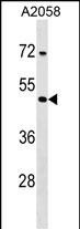 WB - TPRX1 Antibody (N-term) AP16916a