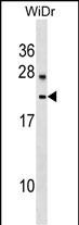 WB - LYZL6 Antibody (Center) AP16919c