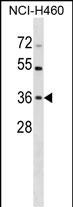 WB - HUS1 Antibody (C-term) AP16922b