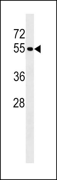 WB - PTPN18 Antibody (C-term) AP16925B