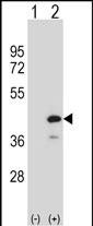 WB - PTPN18 Antibody (C-term) AP16925B