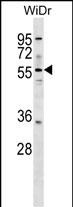 ASNS Antibody (N-term) (Cat. #AP16927a) western blot analysis in WiDr cell line lysates (35ug/lane).This demonstrates the ASNS antibody detected the ASNS protein (arrow).