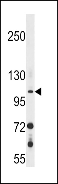 WB - GUCY2F Antibody (C-term) AP16965B