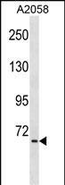 WB - TNIP1 Antibody (C-term) AP16988b