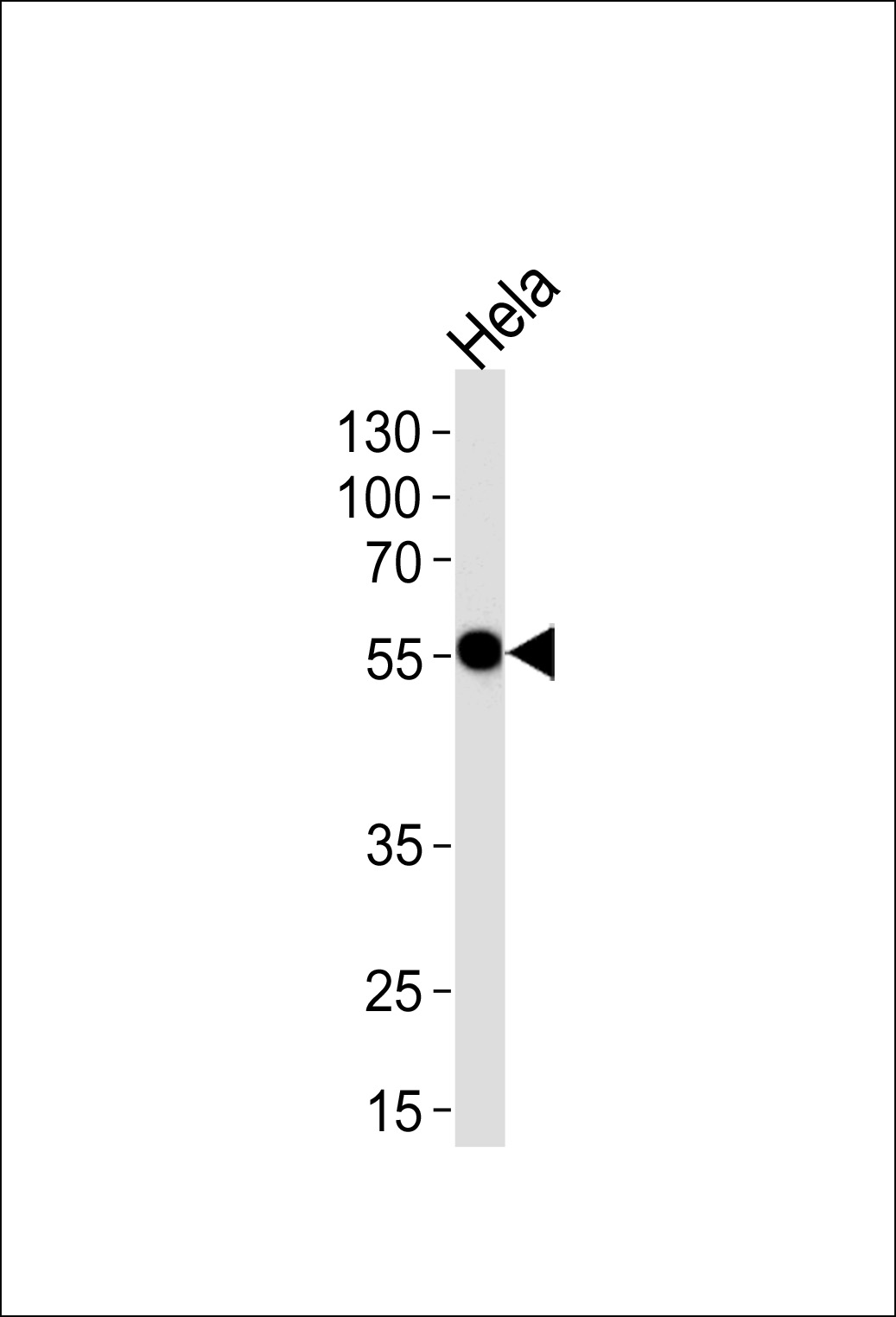 Western blot analysis of lysate from Hela cell line, using DDX6 Antibody (C-term)(Cat. #AP16996b). AP16996b was diluted at 1:1000 at each lane. A goat anti-rabbit IgG H&L(HRP) at 1:5000 dilution was used as the secondary antibody. Lysate at 35ug per lane. 