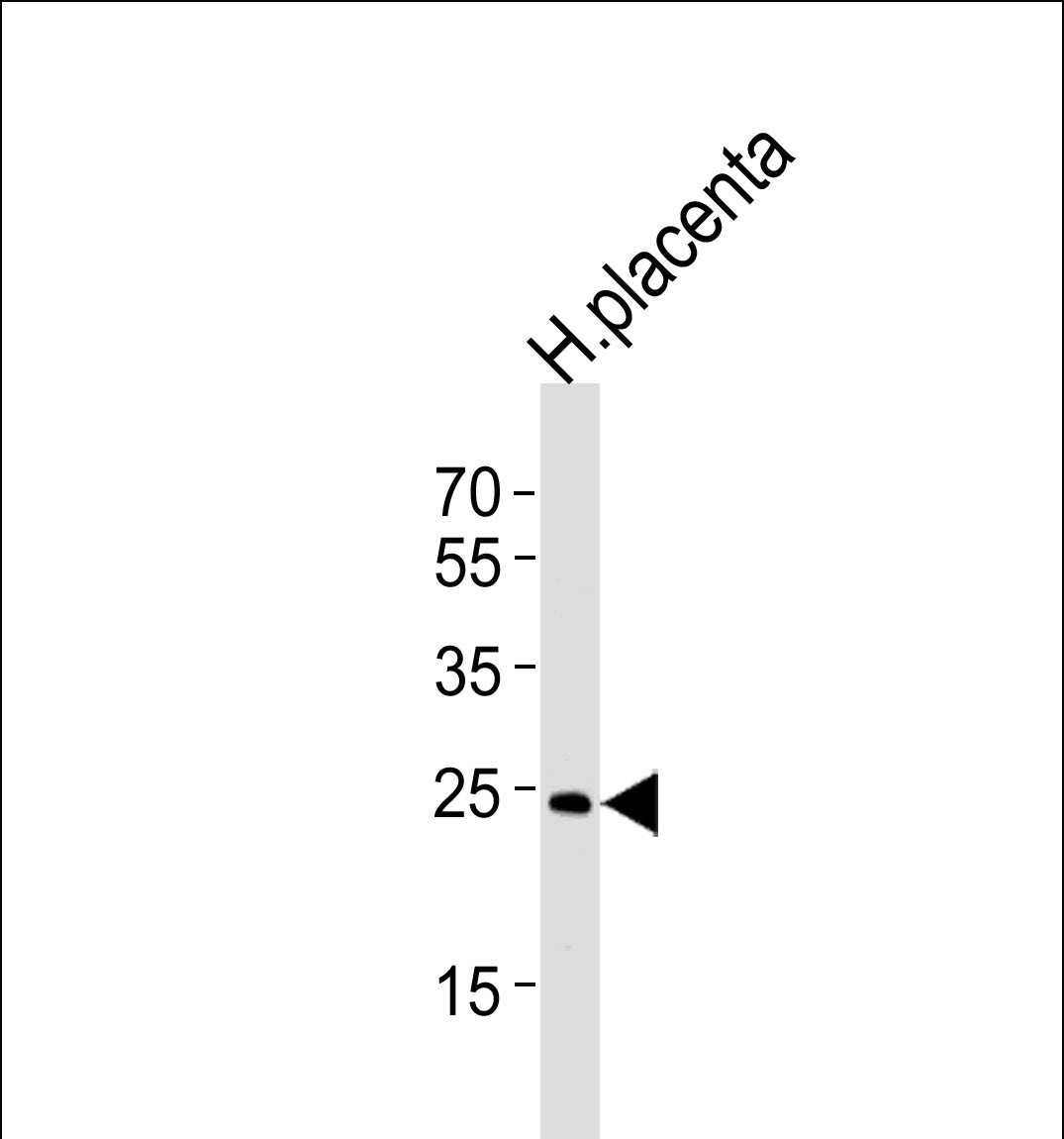 Western blot analysis of lysate from human placenta tissue lysate, using ANP32B Antibody (N-term)(Cat. #AP17005a). AP17005a was diluted at 1:1000 at each lane. A goat anti-rabbit IgG H&L(HRP) at 1:5000 dilution was used as the secondary antibody. Lysate at 35ug per lane. 