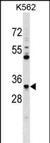 FCN1 Antibody (C-term) (Cat. #AP17029b) western blot analysis in K562 cell line lysates (35ug/lane).This demonstrates the FCN1 antibody detected the FCN1 protein (arrow).