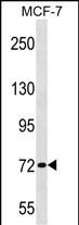WB - ZNF408 Antibody (Center) AP17038c