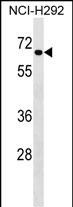 WB - DYRK4 Antibody (Center) AP17039C