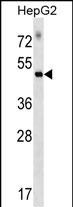 WB - RAPGEF5 Antibody (C-term) AP17073b