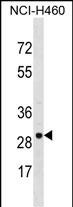 VDAC3 Antibody (Center) (Cat. #AP17092c) western blot analysis in NCI-H460 cell line lysates (35ug/lane).This demonstrates the VDAC3 antibody detected the VDAC3 protein (arrow).