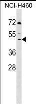 DCPS Antibody (Center) (Cat. #AP17101c) western blot analysis in NCI-H460 cell line lysates (35ug/lane).This demonstrates the DCPS antibody detected the DCPS protein (arrow).