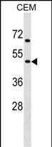 WB - CHRNG Antibody (N-term) AP17105a