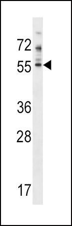 WB - PDE7A Antibody (N-term) AP17110A