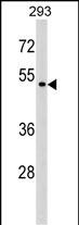 WB - P2RX6 Antibody (Center) AP17114c