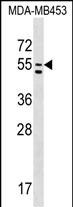 PTDSS1 Antibody (C-term) (Cat. #AP17127b) western blot analysis in MDA-MB453 cell line lysates (35ug/lane).This demonstrates the PTDSS1 antibody detected the PTDSS1 protein (arrow).