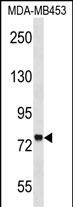 WB - ZNF16 Antibody (N-term) AP17131a