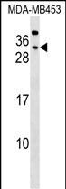 CEACAM7 Antibody (Center) (Cat. #AP17149c) western blot analysis in MDA-MB453 cell line lysates (35ug/lane).This demonstrates the CEACAM7 antibody detected the CEACAM7 protein (arrow).