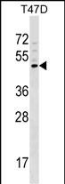 WB - GCNT1 Antibody (Center) AP17151c