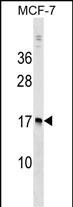 WB - NUDT4 Antibody (N-term) AP17167a