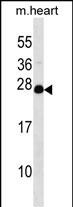 WB - NUDT4 Antibody (N-term) AP17167a