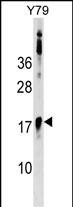 BCL7B Antibody (C-term) (Cat. #AP17168b) western blot analysis in Y79 cell line lysates (35ug/lane).This demonstrates the BCL7B antibody detected the BCL7B protein (arrow).