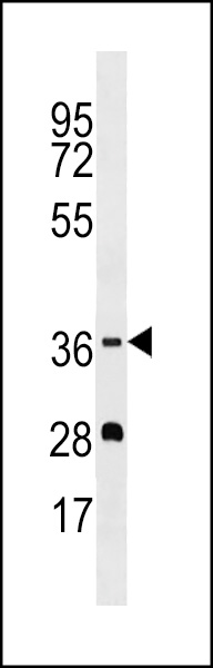 WB - OR5M1 Antibody (C-term) AP17176b