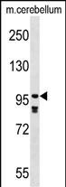 WB - PDE4A Antibody (N-term) AP17181a