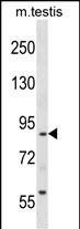 WB - RTN1 Antibody (N-term) AP17182a
