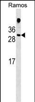 WB - HDGFL1 Antibody (Center) AP17185c