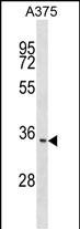 WB - ITM2C Antibody (N-term) AP17192a