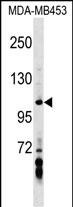 AXIN1 Antibody (Center) (Cat. #AP17201c) western blot analysis in MDA-MB453 cell line lysates (35ug/lane).This demonstrates the AXIN1 antibody detected the AXIN1 protein (arrow).