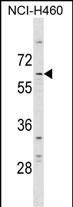 DCP1A Antibody (N-term) (Cat. #AP17207a) western blot analysis in NCI-H460 cell line lysates (35ug/lane).This demonstrates the DCP1A antibody detected the DCP1A protein (arrow).
