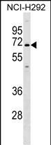 WB - KCNN1 Antibody (C-term) AP17223b