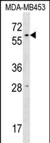 WB - RPUSD2 Antibody (N-term) AP17227a