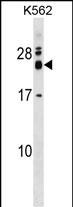 REXO2 Antibody (Center) (Cat. #AP17251c) western blot analysis in K562 cell line lysates (35ug/lane).This demonstrates the REXO2 antibody detected the REXO2 protein (arrow).