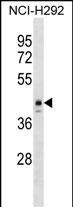 WB - ESX1 Antibody (N-term) AP17259a