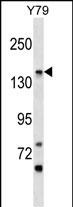 PIGO Antibody (C-term) (Cat. #AP17269b) western blot analysis in Y79 cell line lysates (35ug/lane).This demonstrates the PIGO antibody detected the PIGO protein (arrow).