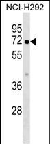 WB - ZBTB44 Antibody (C-term) AP17273b