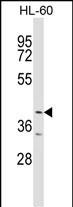 ABTB1 Antibody (C-term) (Cat. #AP17274b) western blot analysis in HL-60 cell line lysates (35ug/lane).This demonstrates the ABTB1 antibody detected the ABTB1 protein (arrow).