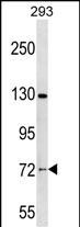 WB - NOL4 Antibody (C-term) AP17278B