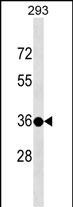 WB - TSPY3 Antibody (C-term) AP17280b