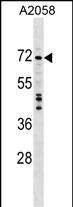 DDX56 Antibody (C-term) (Cat. #AP17303b) western blot analysis in A2058 cell line lysates (35ug/lane).This demonstrates the DDX56 antibody detected the DDX56 protein (arrow).