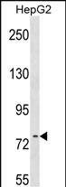 WB - RRN3 Antibody (Center) AP17305c