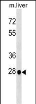 WB - Mouse Hoxb5 Antibody (N-term) AP17307a
