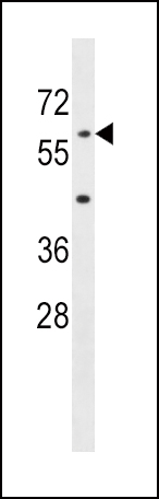AOAH Antibody (Center) (Cat. #AP17325c) western blot analysis in mouse liver tissue lysates (35ug/lane).This demonstrates the AOAH antibody detected the AOAH protein (arrow).