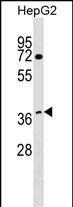 WB - WDR68 Antibody (C-term) AP17326b