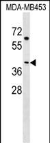 WB - NECAB2 Antibody (N-term) AP17328A