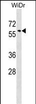 WB - SNX18 Antibody (C-term) AP17333b