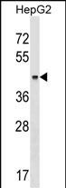 WB - KRT23 Antibody (Center) AP17336c